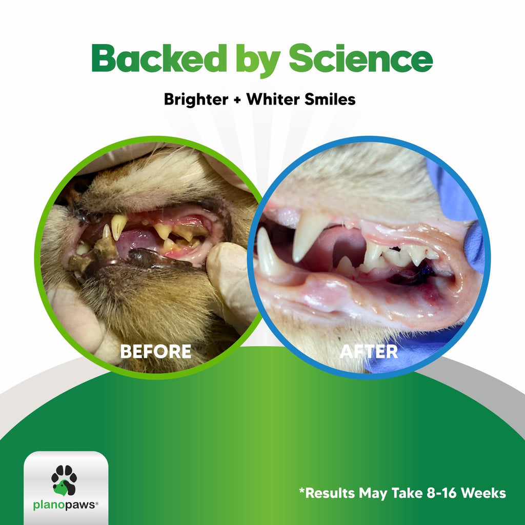 Dental Powder for Teeth Cleaning G1986